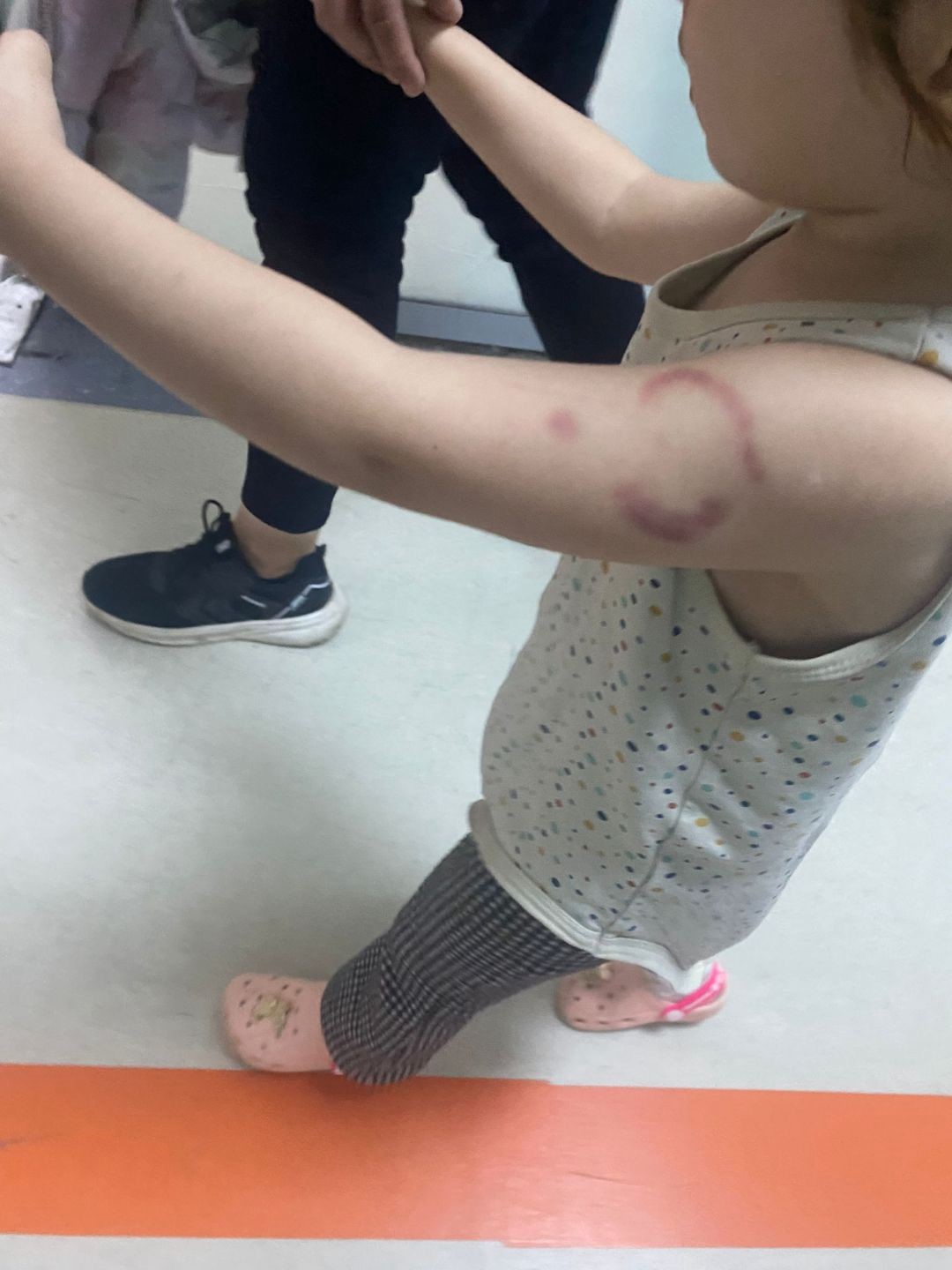 Edirne&rsquo;de &ouml;ğrencisini ısıran &ouml;ğretmen tutuklandı
