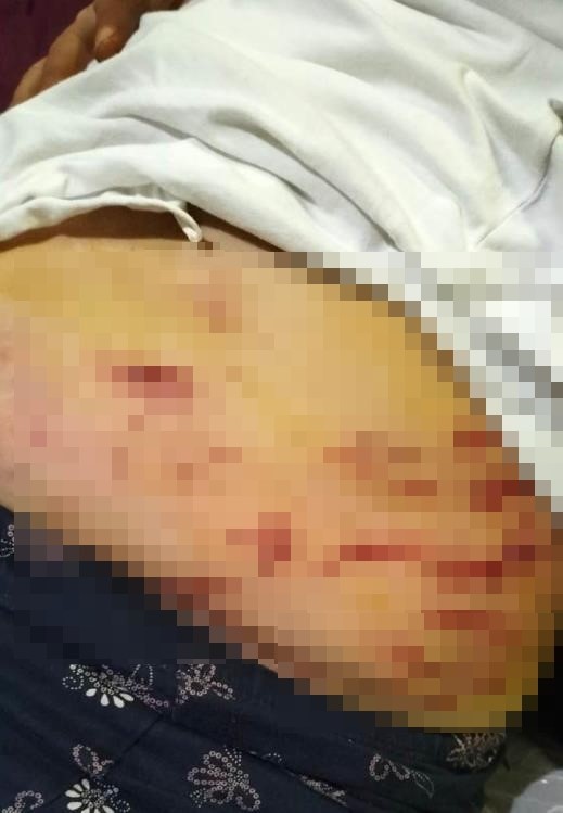 Sokakta ağızlıksız gezdirilen ’Rottweiler’ cinsi köpek dehşet saçtı... O anlar kamerada
