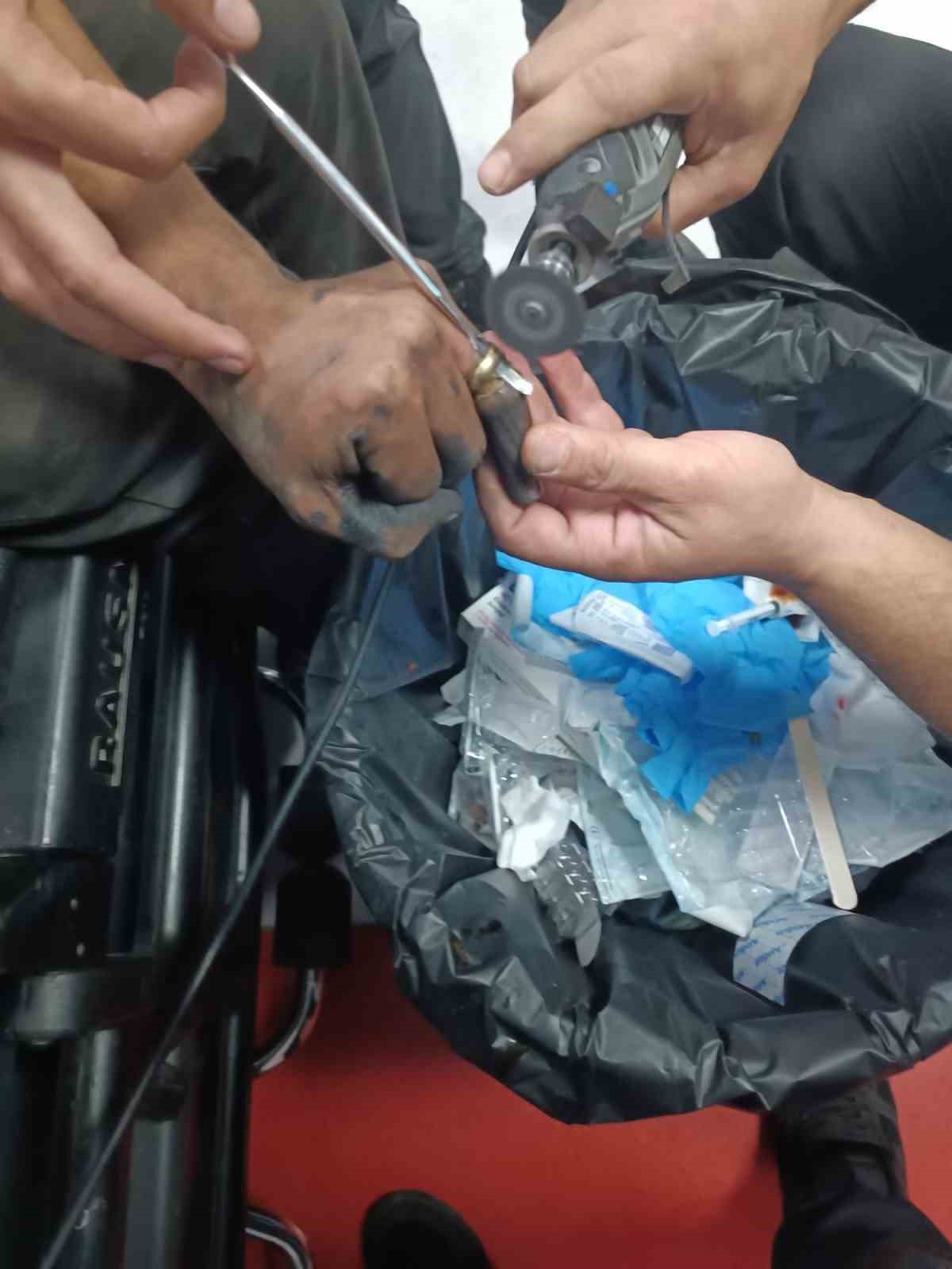 Parmakta sıkışan yüzük, hastanede doktor ve itfaiye ekibi tarafından çıkartıldı