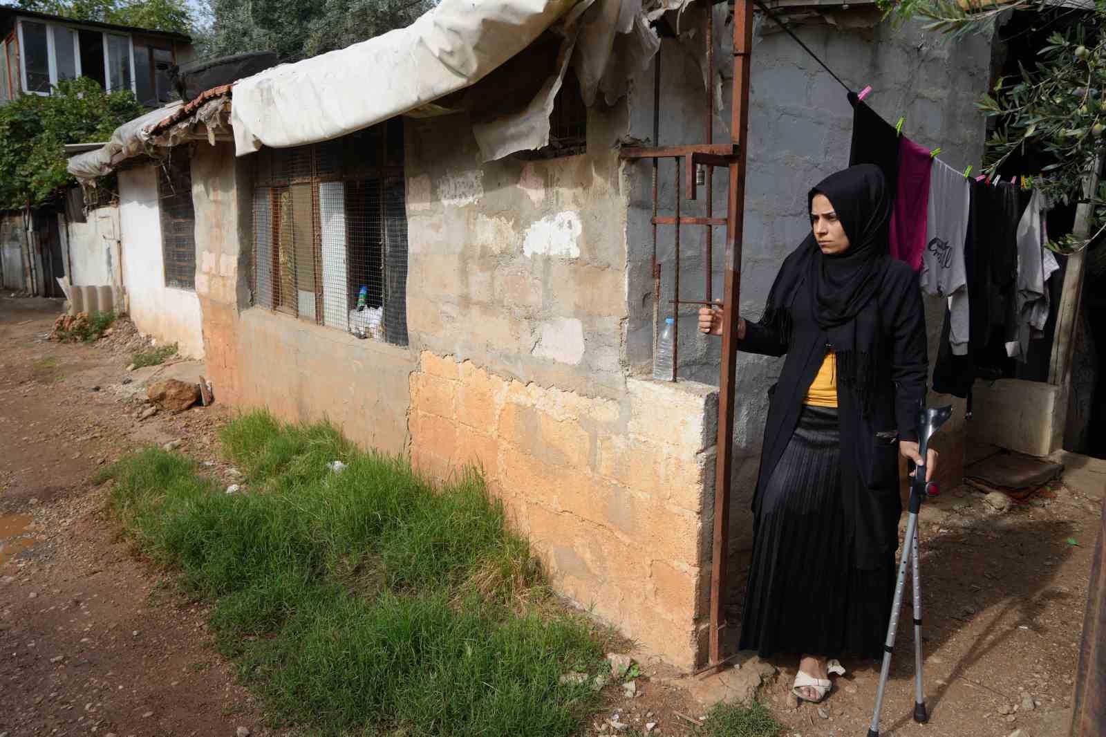 Kahramanmaraş merkezli büyük depremde bacağını kaybetti, eşi terk etti