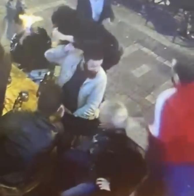 Kadıköy’de dehşet anlarının görüntüsü ortaya çıktı... Genç kadının yüzünü böyle yaktı
