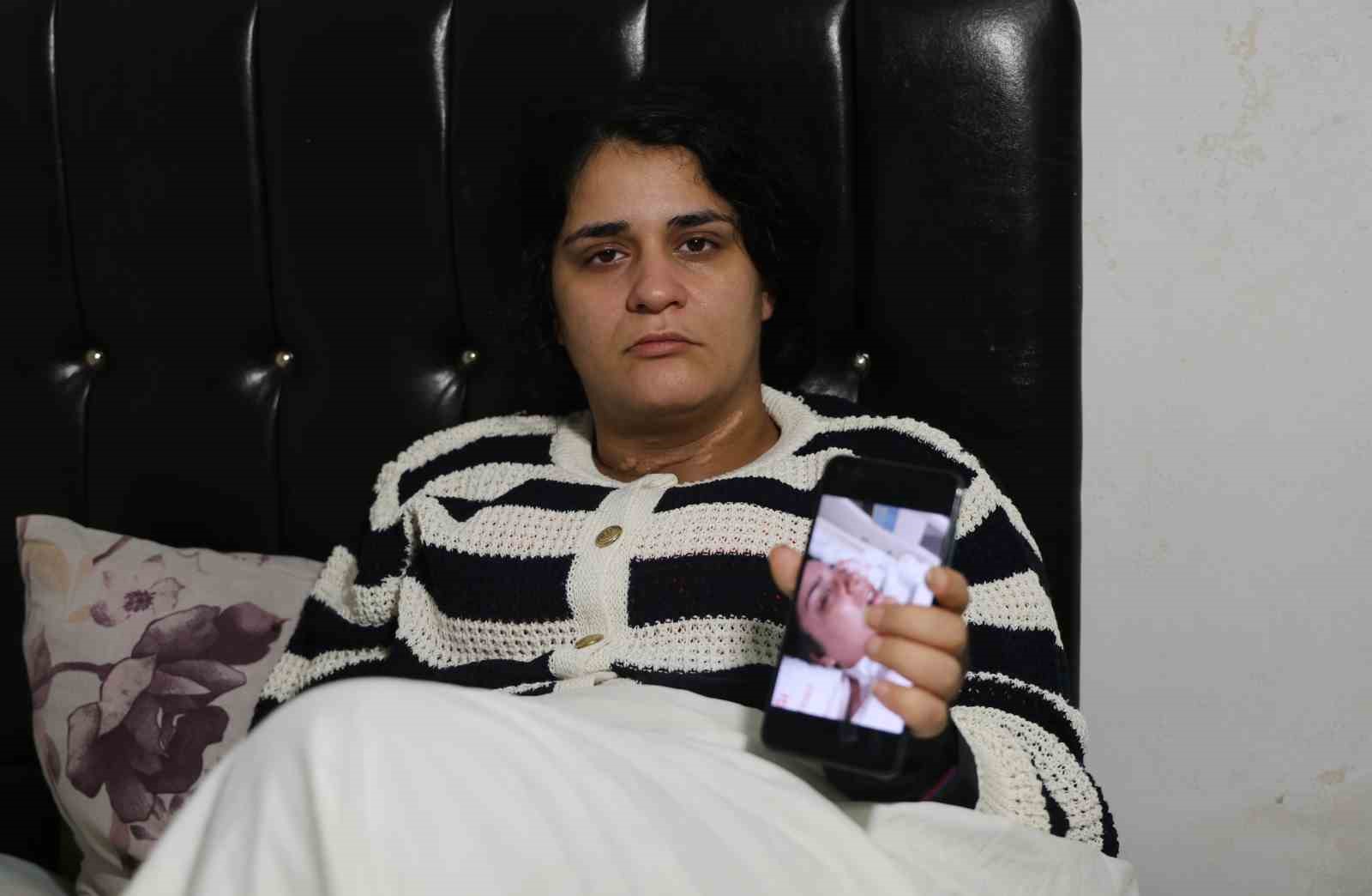 Eşi boğazını kesti engelli kaldı: 2 çocuk annesi dehşet anlarını ilk kez anlattı