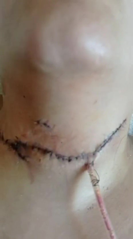 Nazmiye&rsquo;yi boğazından bı&ccedil;aklayan saldırganın babası: "Ben torunlarımı istiyorum"
