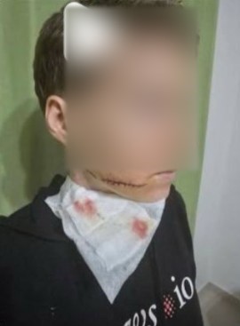 Alanya’da sokakta kadına saldırıda bulunan şahıs yakalandı