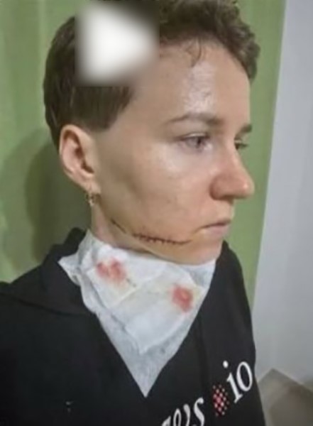 Alanya&rsquo;da sokakta kadına saldırıda bulunan şahıs adliyeye sevk edildi
