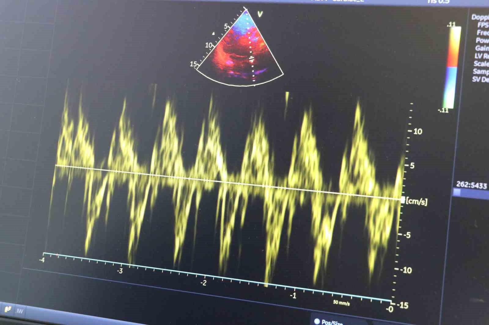 Uzmanı uyardı: "Kalp hastaları soğuk havada daha dikkatli olmalı"