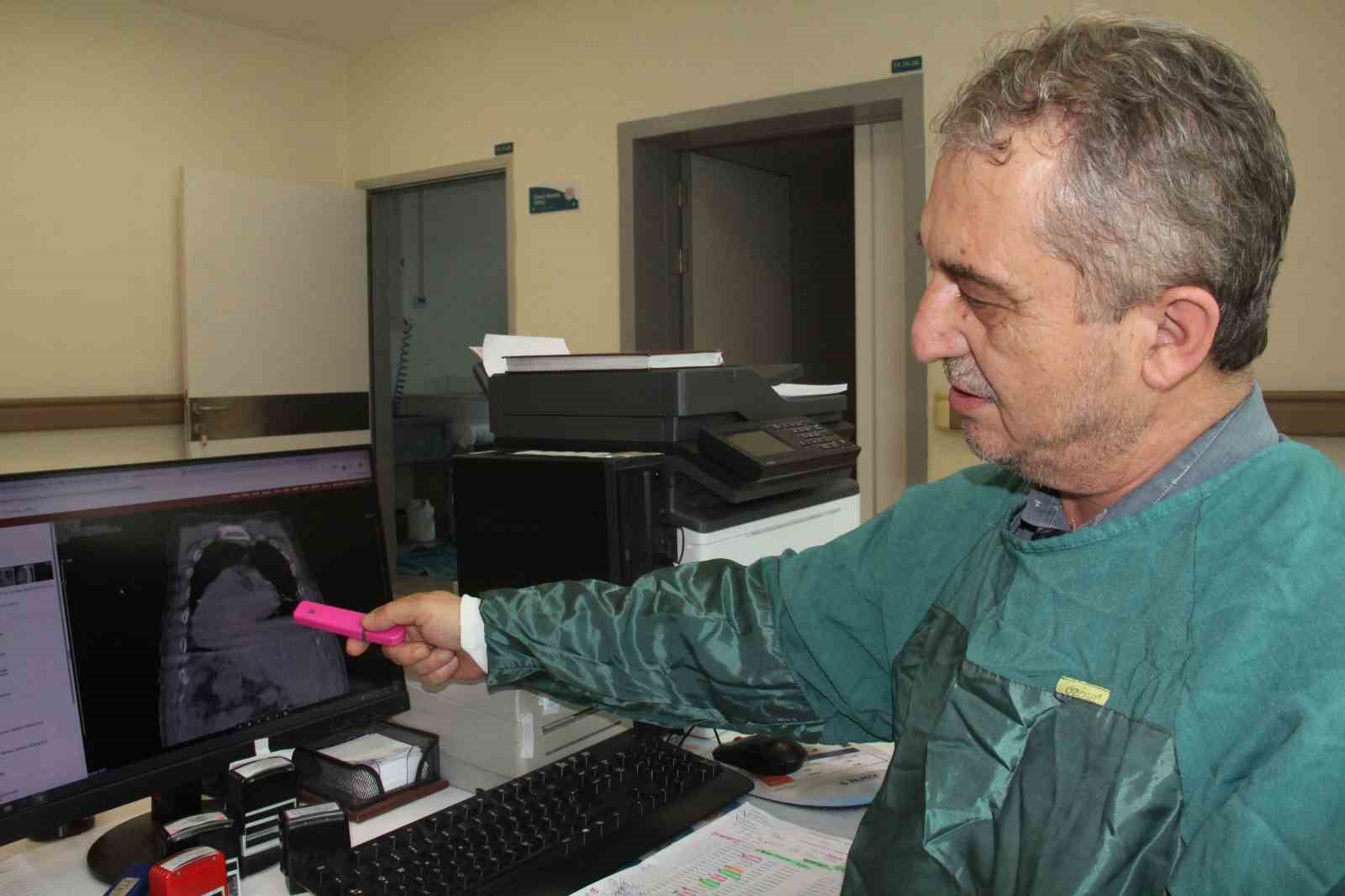 Giresun’dan tıp literatürüne yeni bir yaklaşım: "Karadeniz PEG Kuralı"