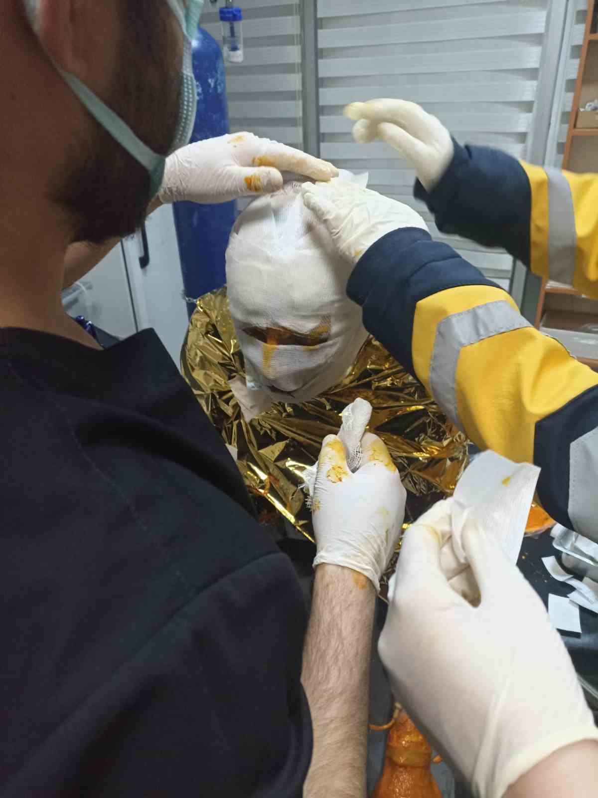 (DÜZETLTME) Erzurum’da kömür ocağında yangın: 2 işçi yaralı