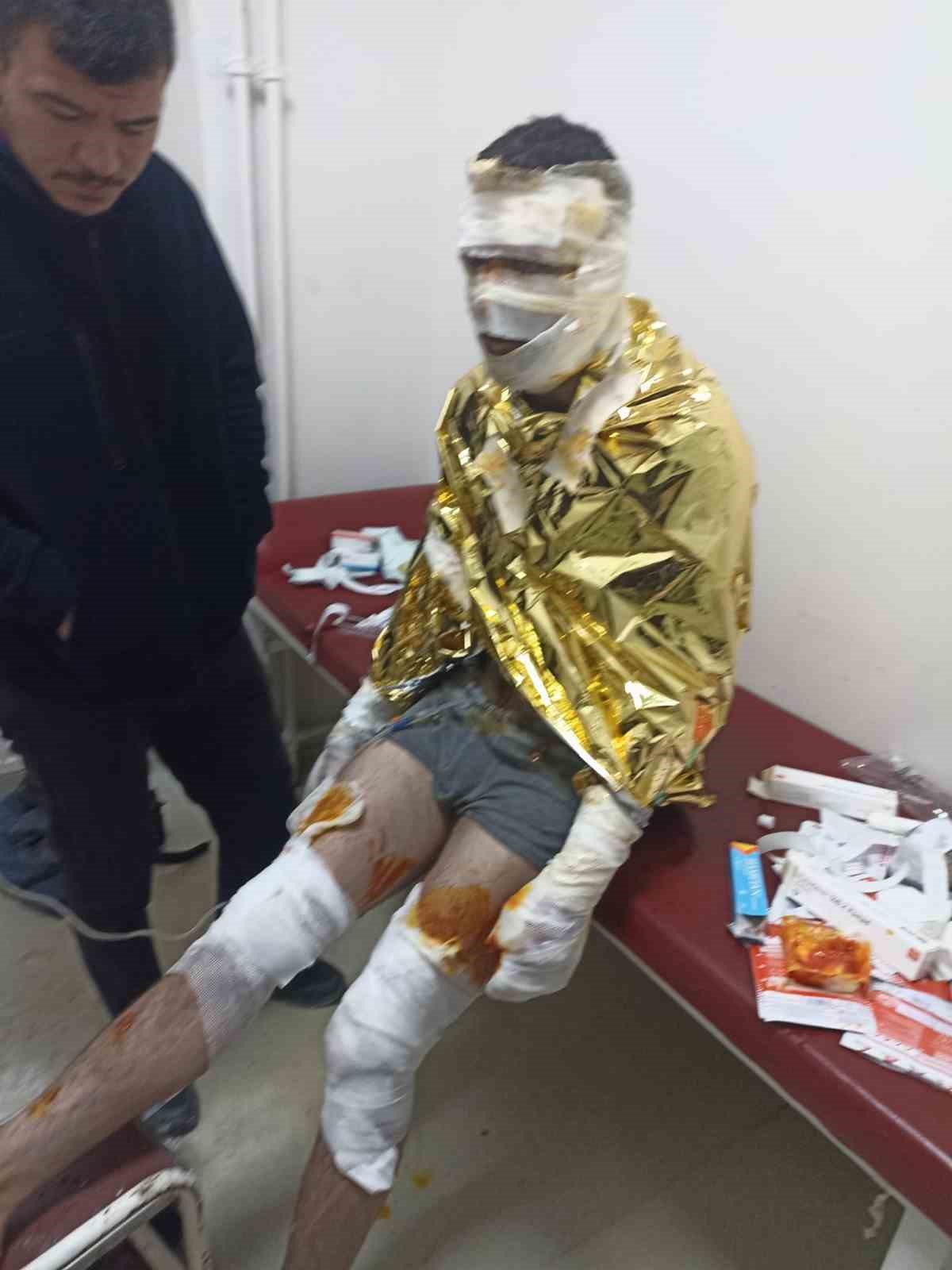 (DÜZETLTME) Erzurum’da kömür ocağında yangın: 2 işçi yaralı
