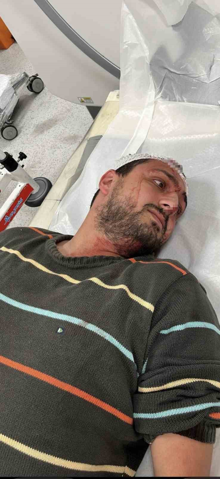 Otizmli genci "odunluğa baktı" diye darbeden fırın &ccedil;alışanı tutuklandı
