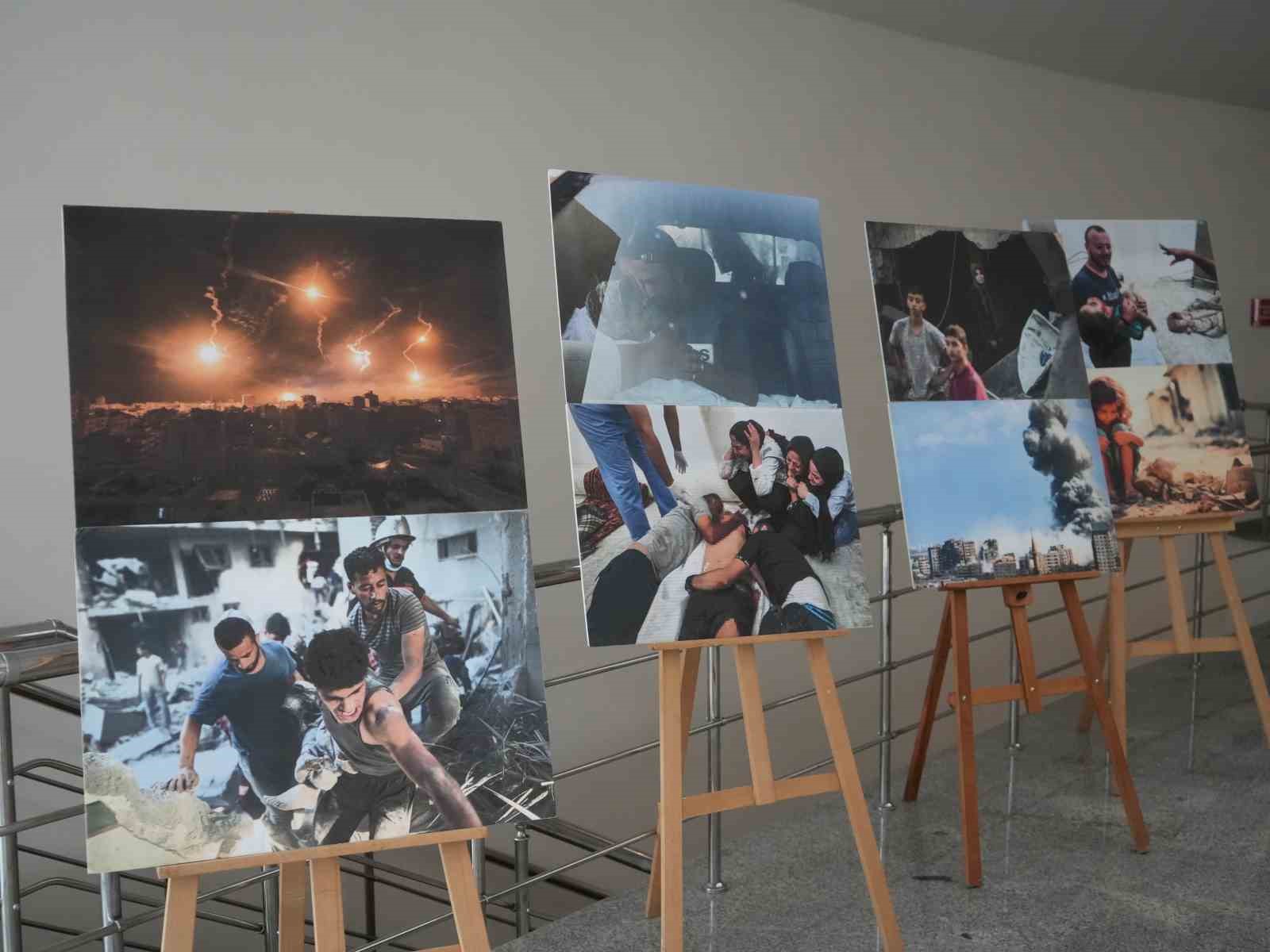 İsrail saldırısında bir bacağını kaybeden Filistinli gazeteci, Gazze’deki zulmü anlattı
