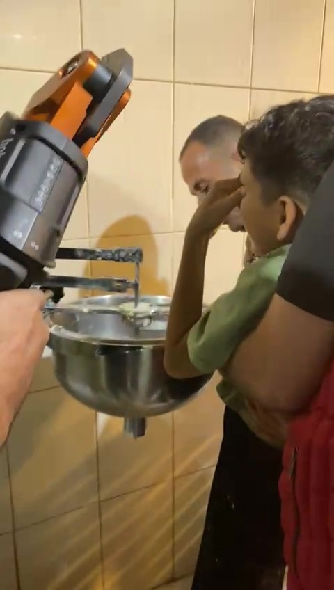 Hamur karıştırma makinesine elini sıkıştıran çocuğu itfaiye kurtardı