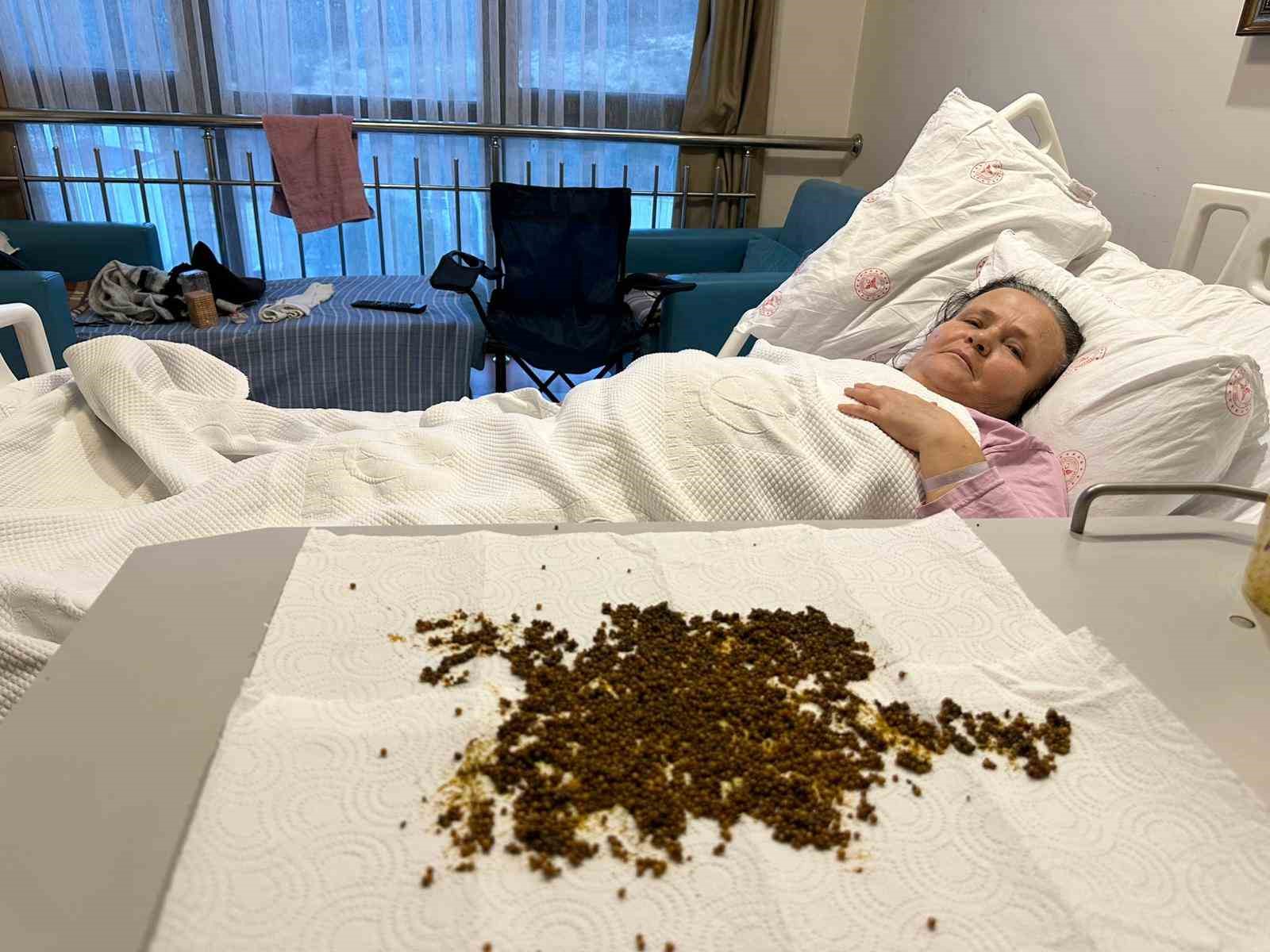 Hastadan çıkan taşları sayamadılar