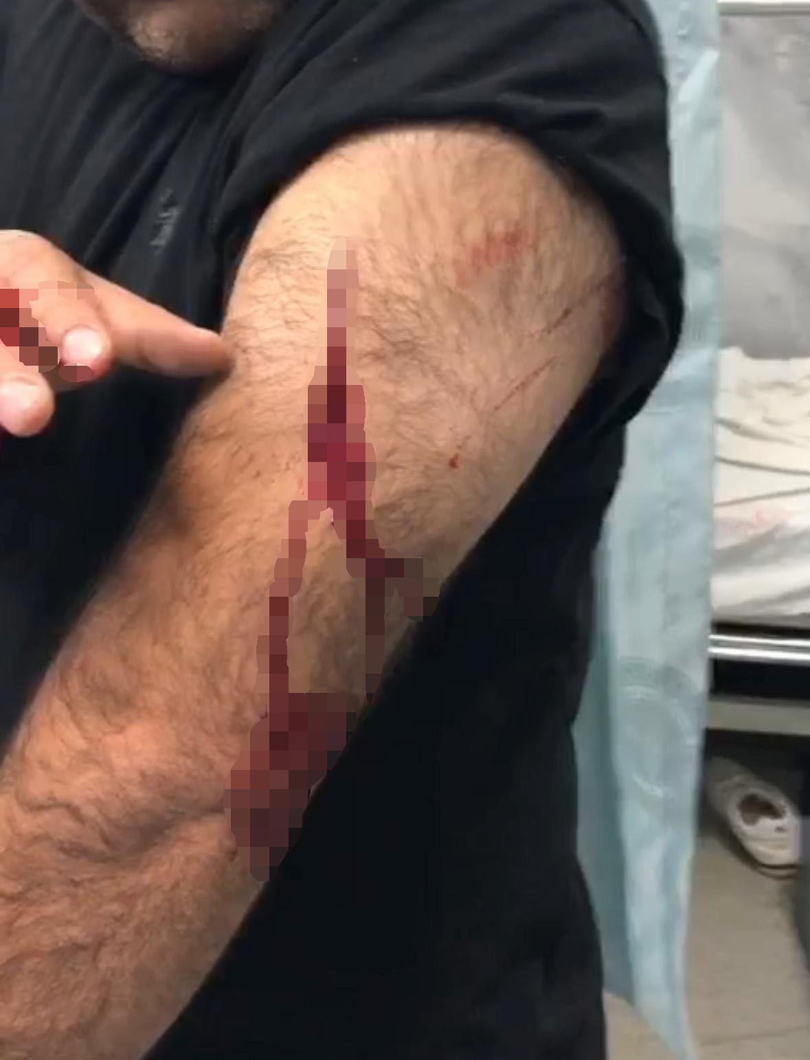 Şanlıurfa’da görev yapan öğretmene sokak ortasında jiletli saldırı
