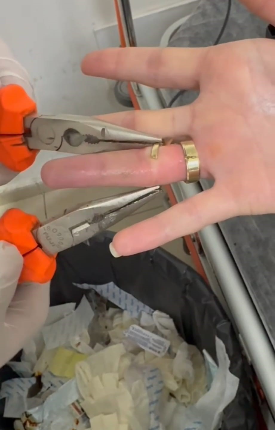 Batman’da parmağa sıkışan iki yüzük ’spiral makine’ ile çıkarıldı