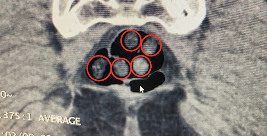 Bitlis’teki uyuşturucu operasyonunda 3 kişi tutuklandı