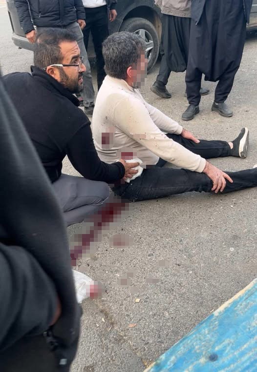 Şanlıurfa’da bıçaklı kavga: 1 yaralı