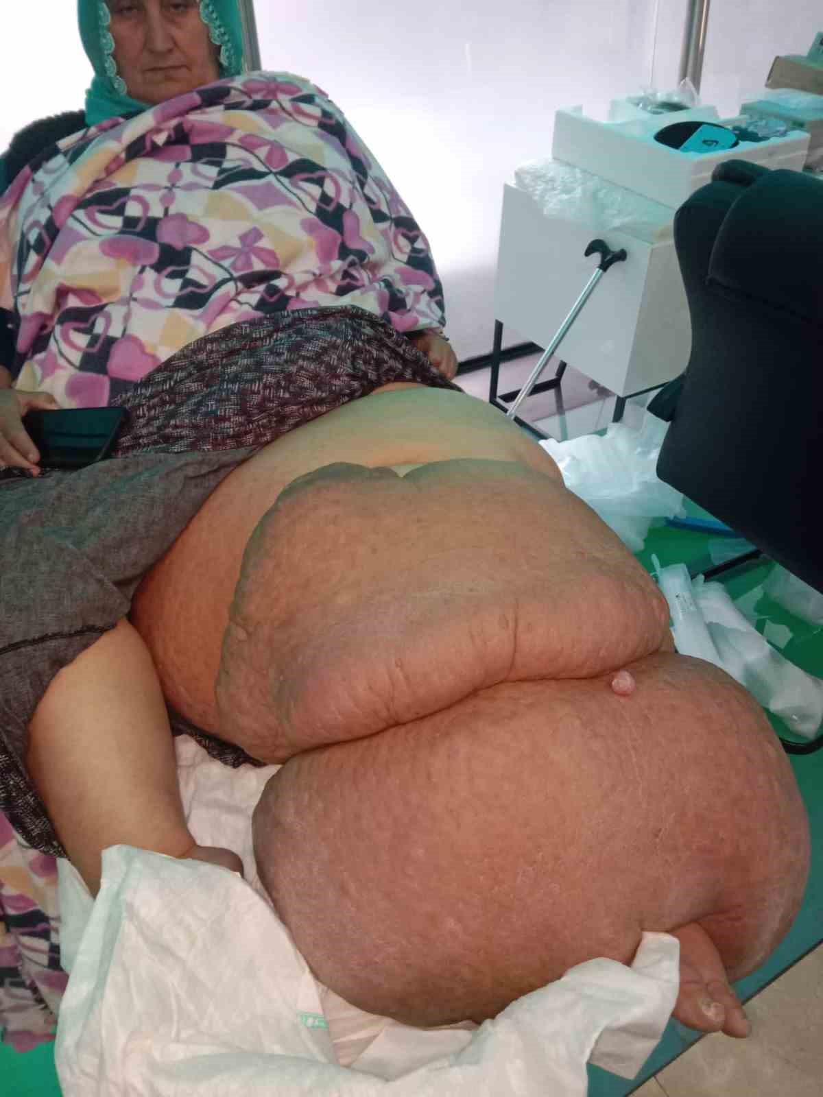 Fil hastal bacan 100 kilo yapt, tedavisinin devam iin destek bekliyor
