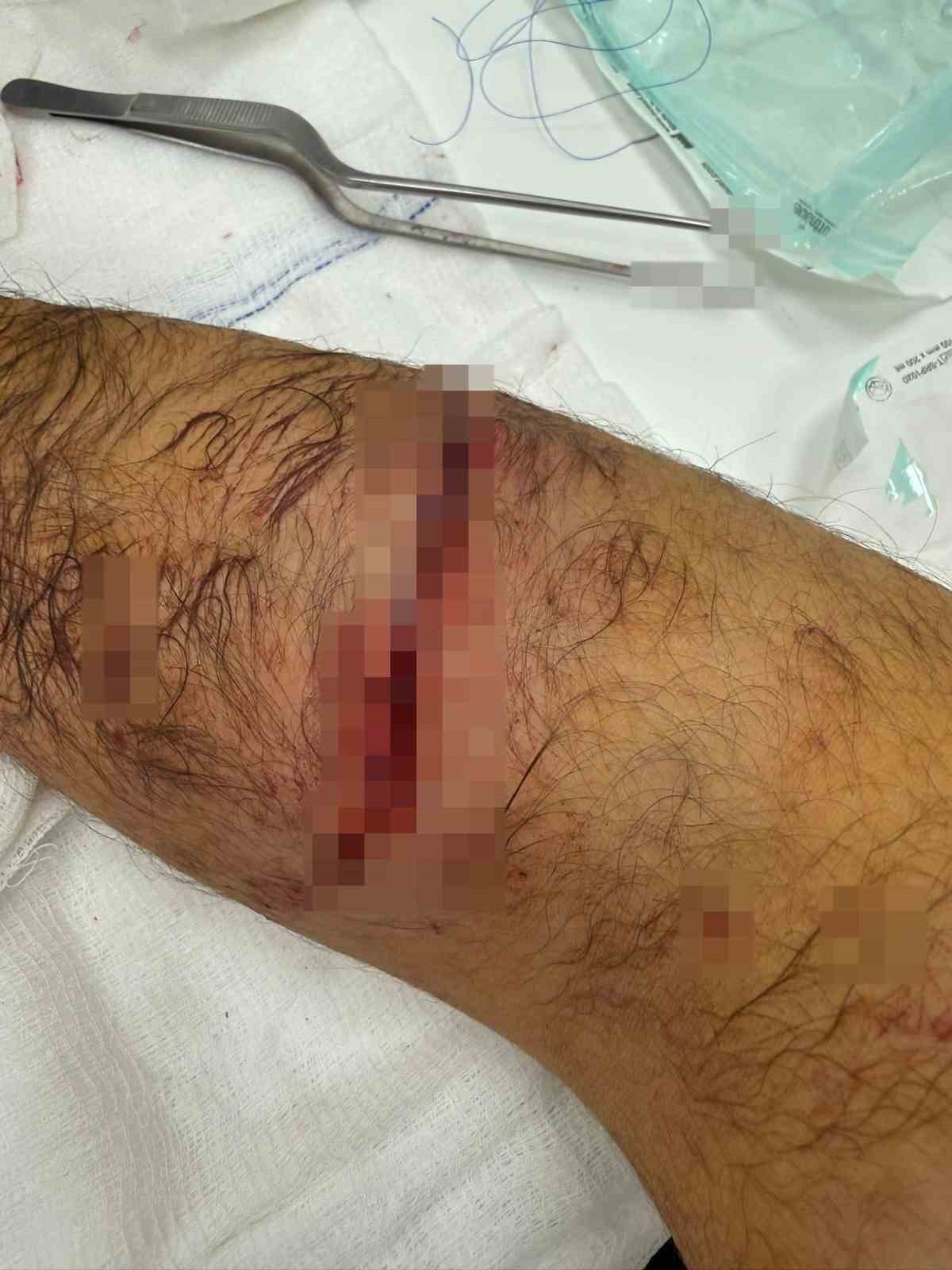 Başakşehir’de sitenin güvenlik görevlisine sahipli köpek saldırdı
