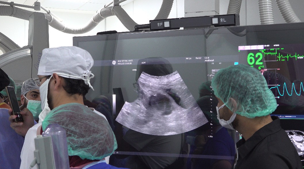 "İğneyle" tümör tedavisine uluslararası ilgi: Canlı canlı izlediler
