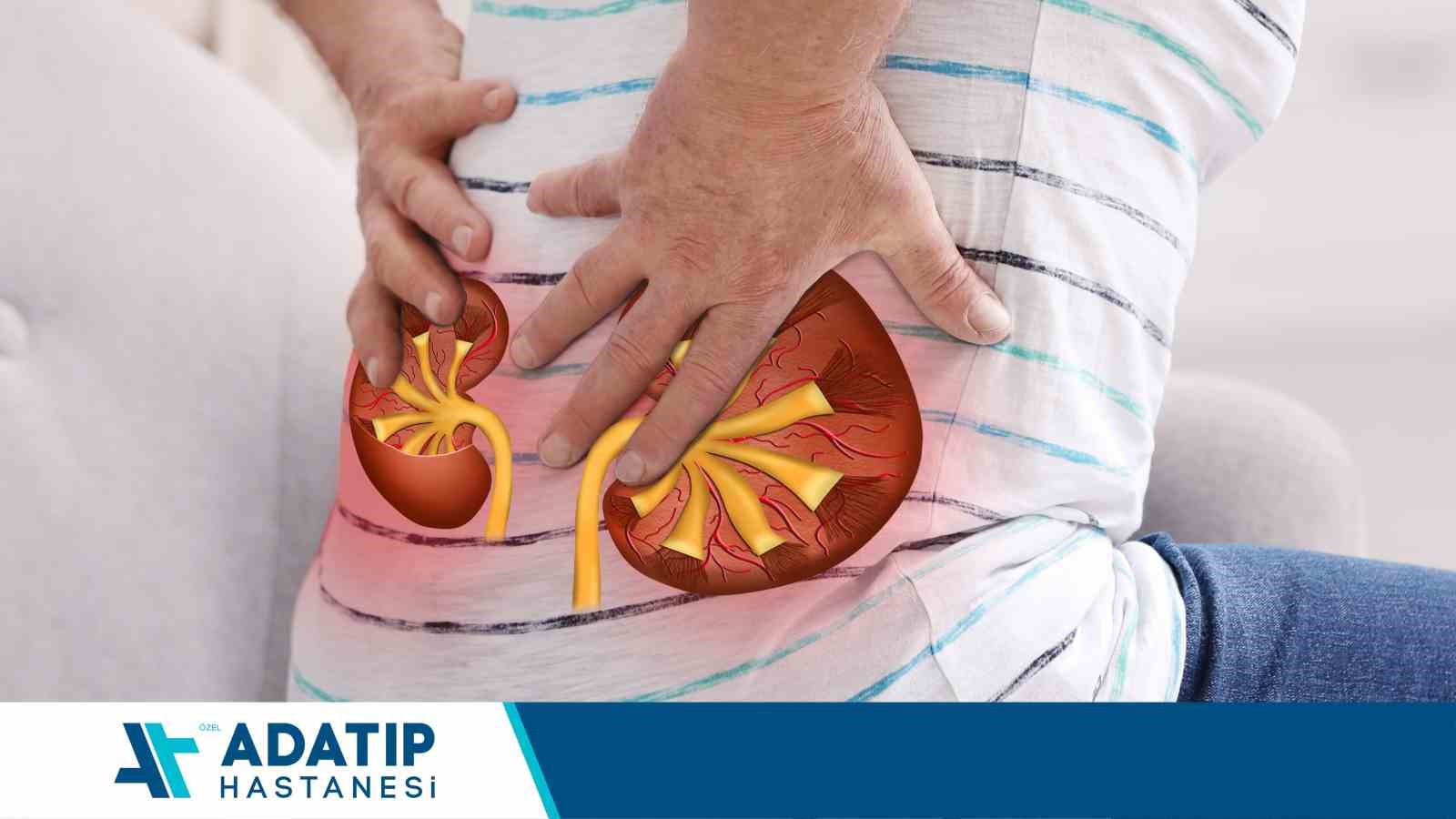 Böbrek taşı vakalarında kişiye özel tedavi