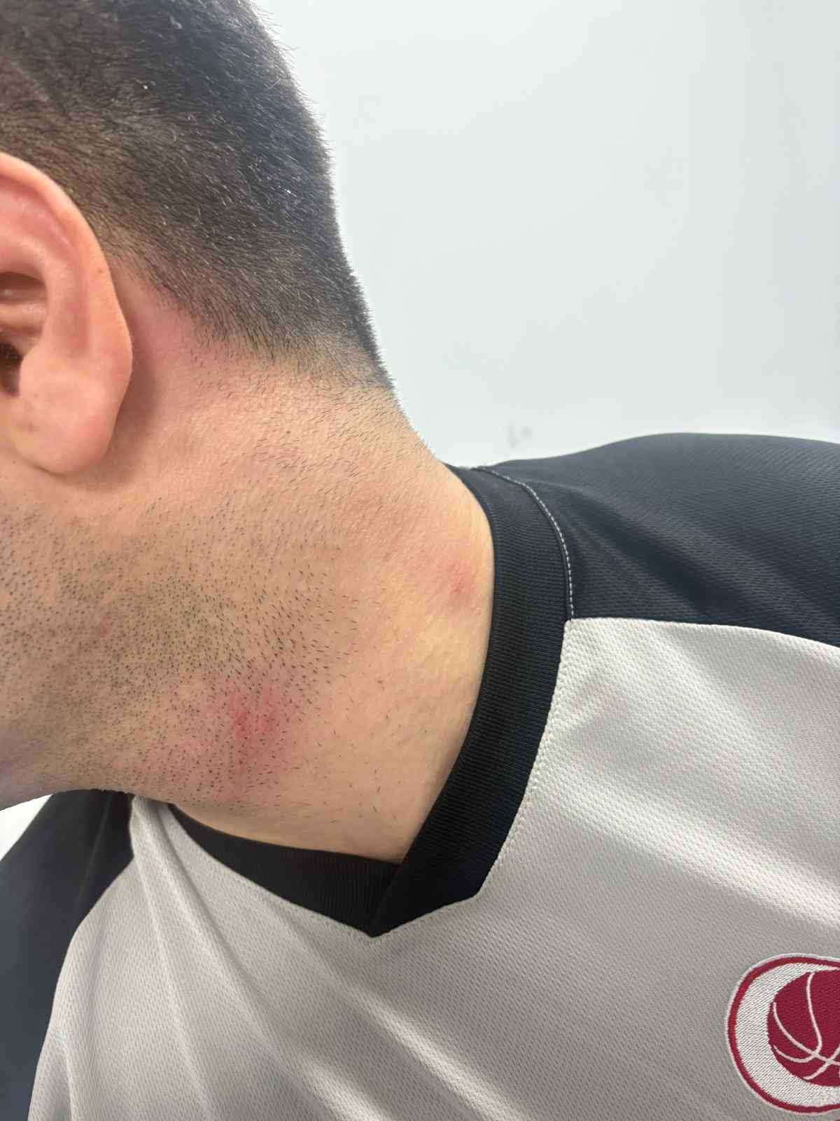 Samsun’da basketbol maçında oyuncu, hakeme saldırdı