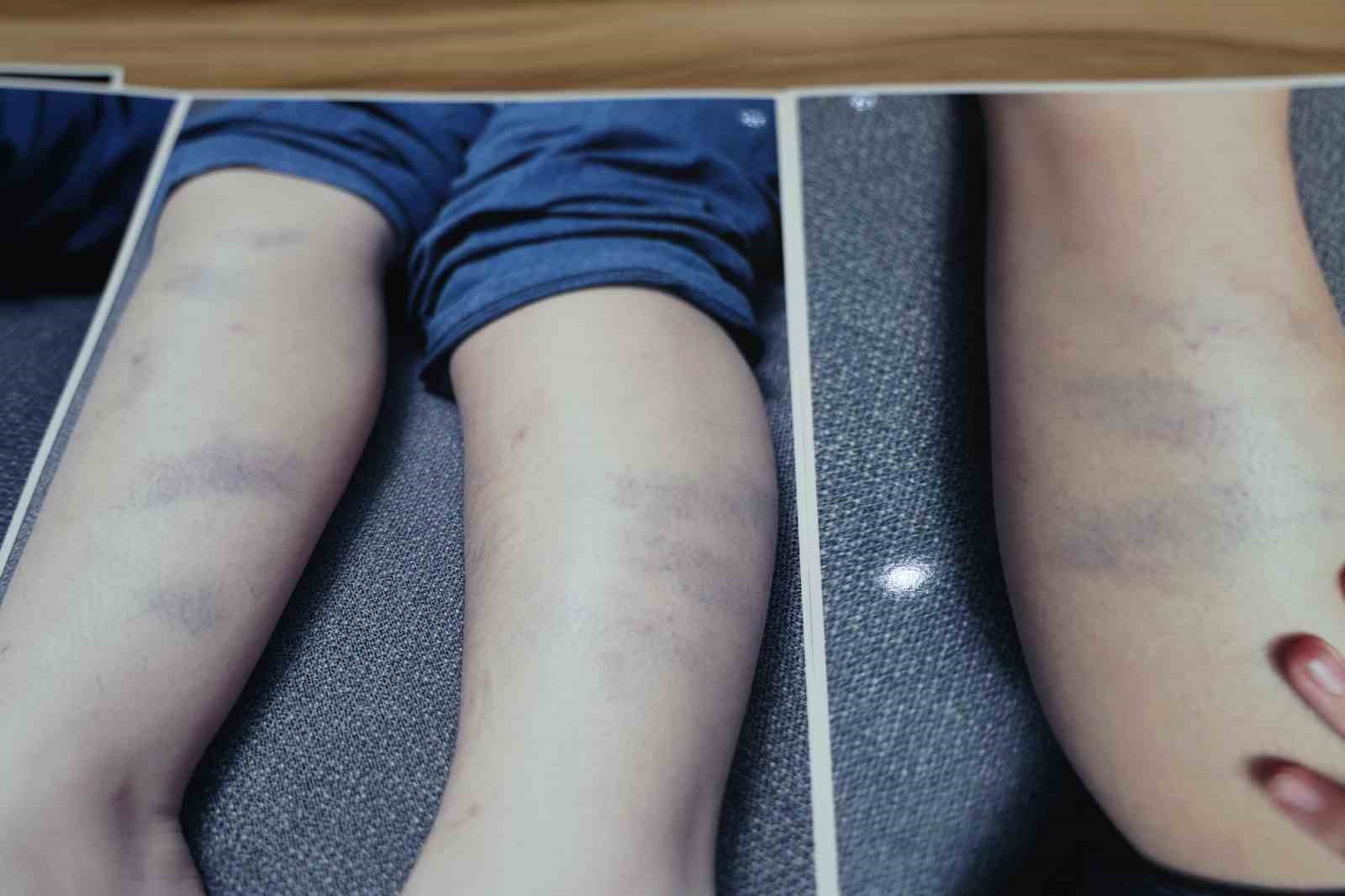 Diyarbakır’da özel okulda 8 yaşındaki çocuğun darbedildiği iddiası