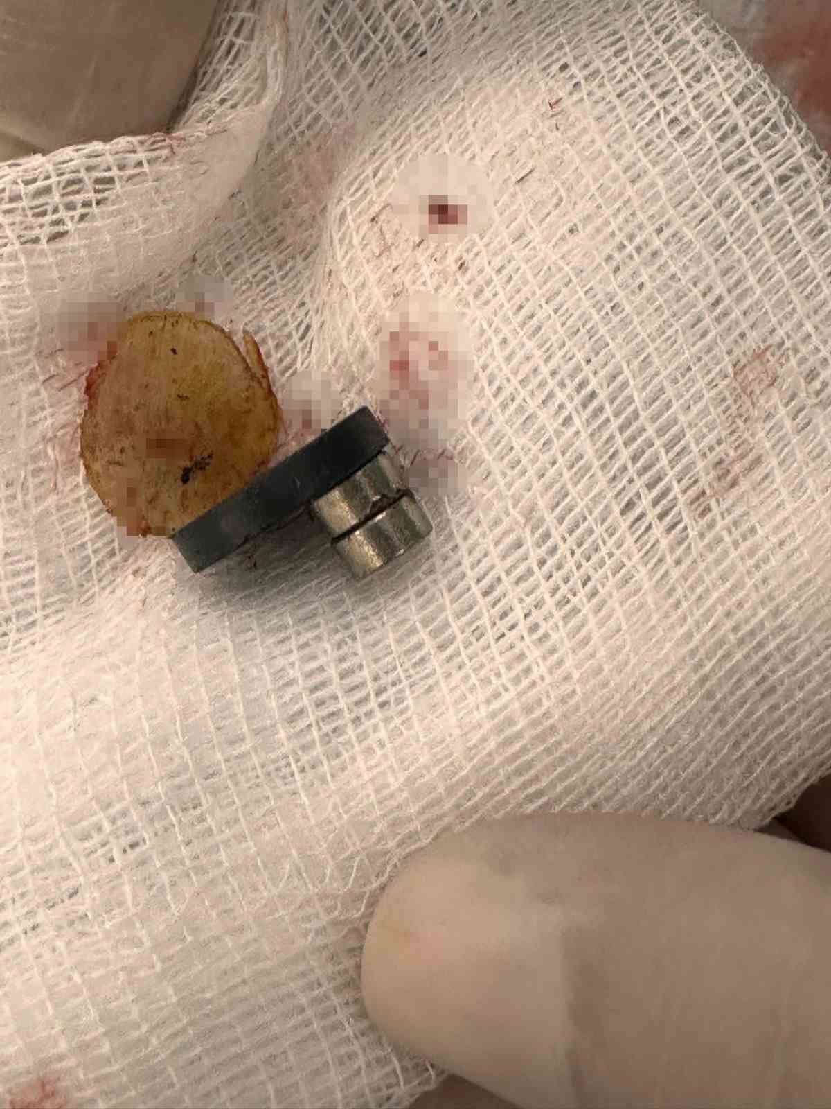 Bebeğin yuttuğu mıknatıslar bağırsak delinmesine neden oldu