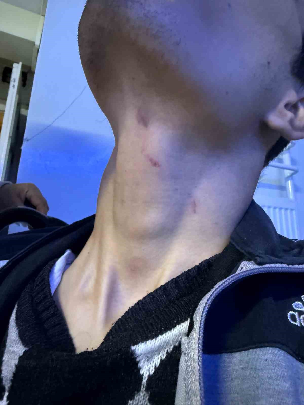 Gaziantep&rsquo;te engelli bakım merkezinde darp skandalı: Merkezde kalan gencin kafasına 6 dikiş atıldı
