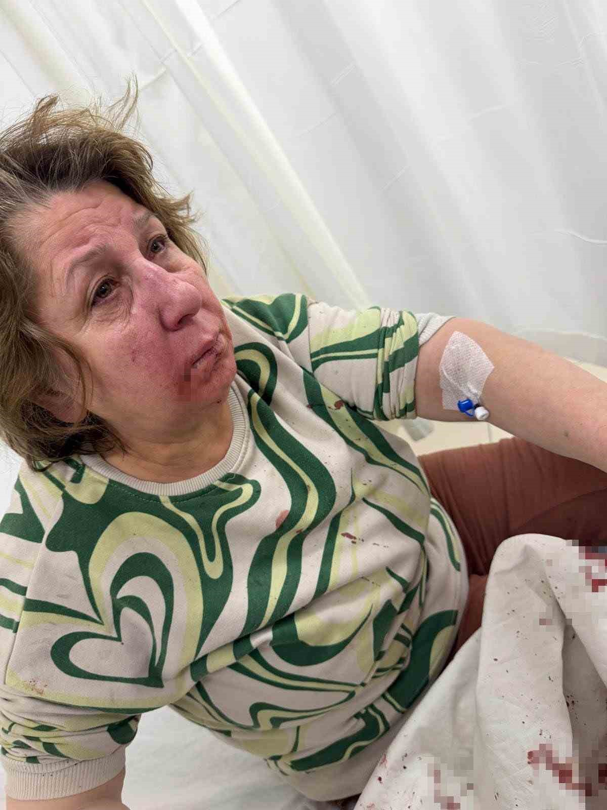 Komşusunu darp eden sivil memur hakkında soruşturma a&ccedil;ıldı
