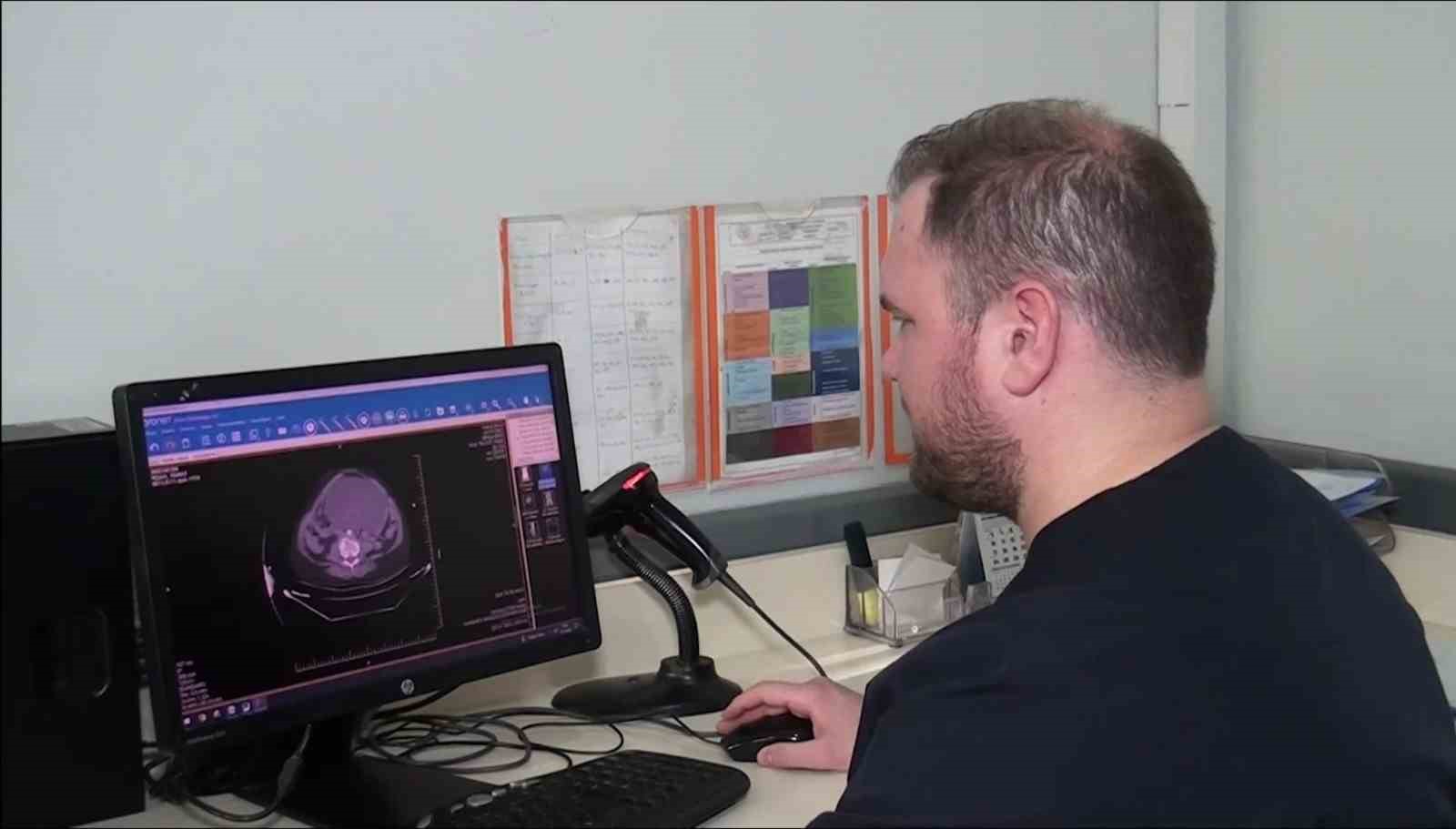 Şanlıurfa&rsquo;da 25 santimetrelik dev kist ameliyatla alındı
