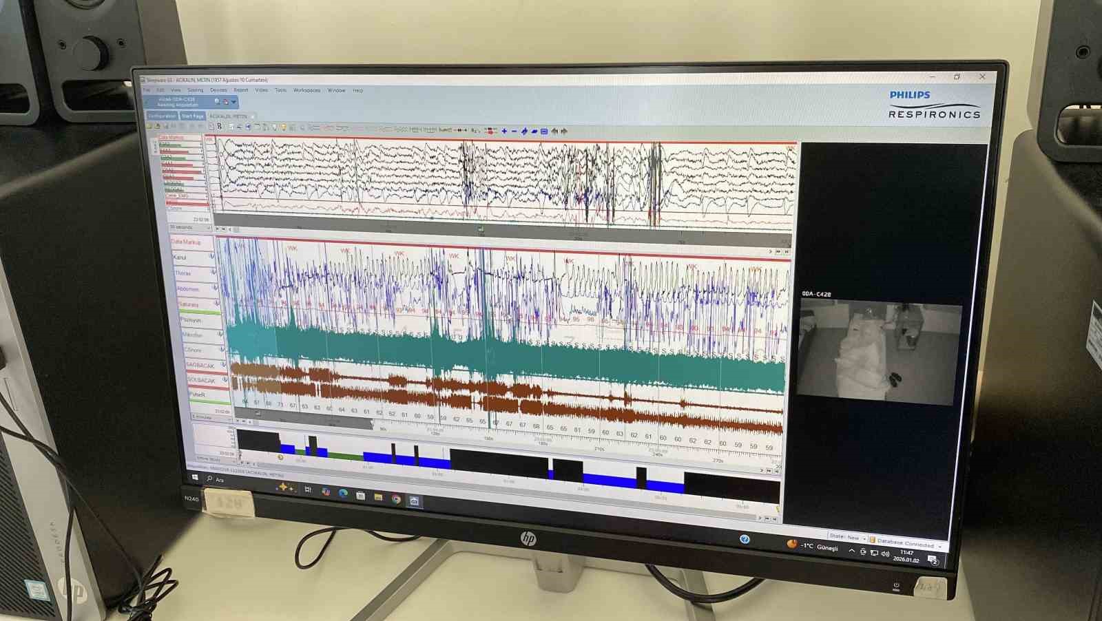 Eskişehir Şehir Hastanesi’nde nöroloji hastalarına ileri tedavi imkanları sunuluyor