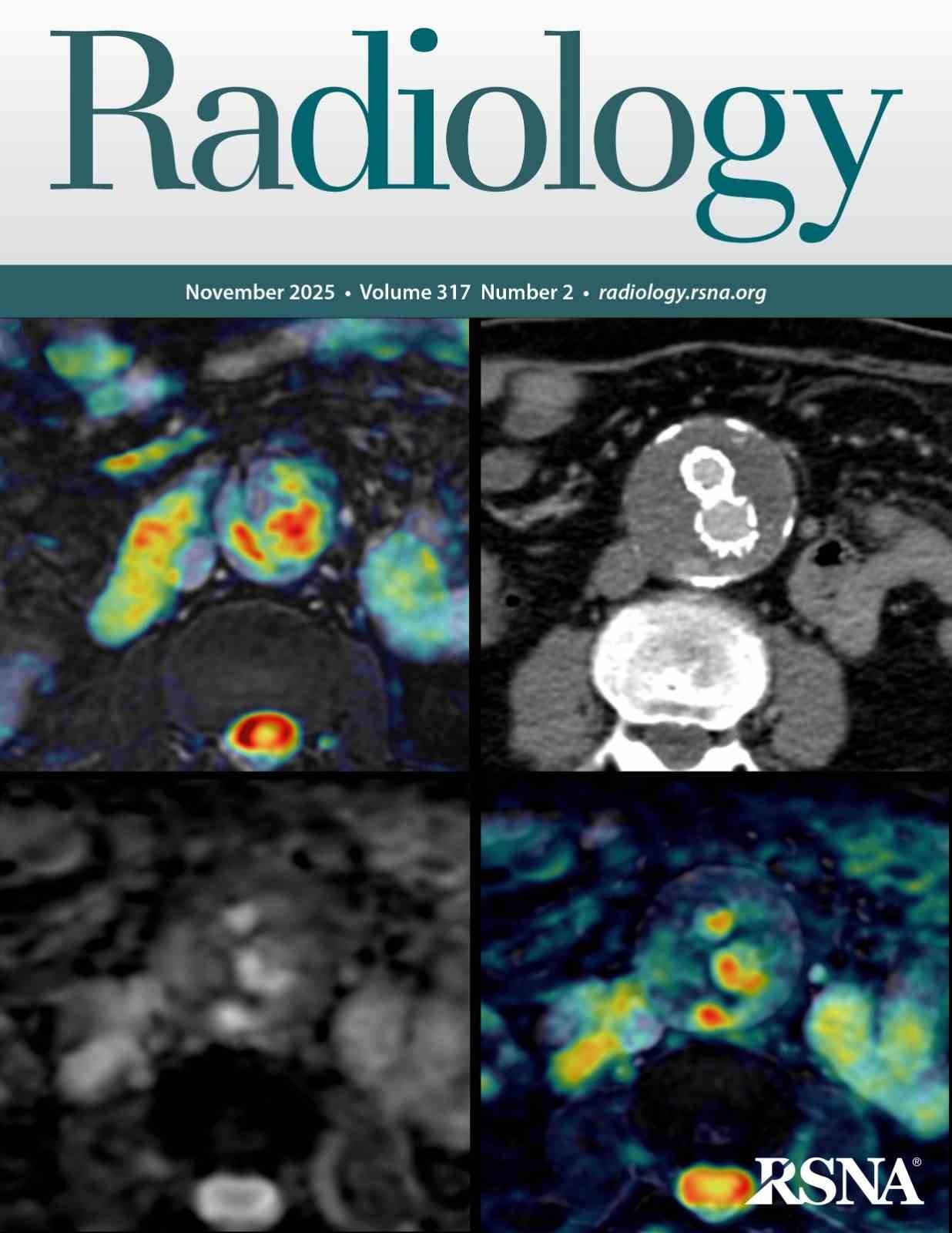 Tekden&rsquo;de başarılı &ccedil;alışmalara imza atan radyoloji uzmanından hayati tespit
