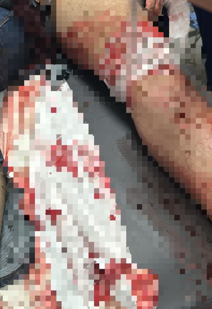 Trafik cezası y&uuml;z&uuml;nden 20 yaşındaki arkadaşını bı&ccedil;akladı
