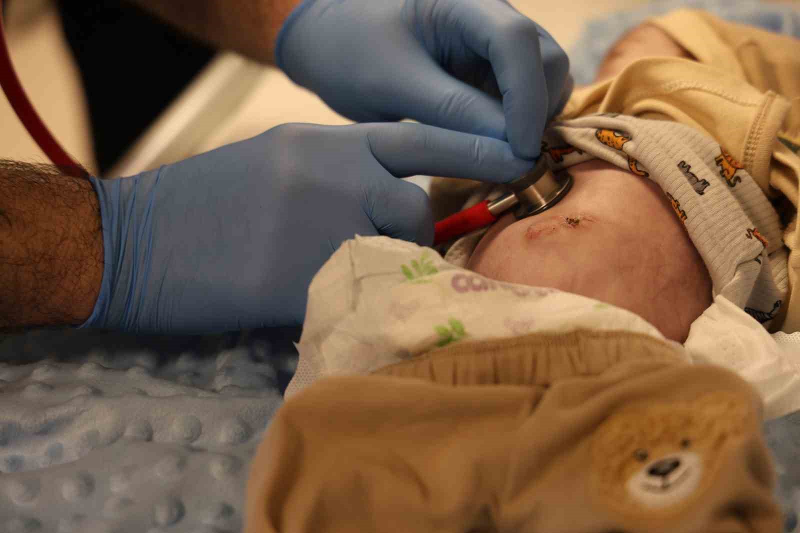 Mide ve bağırsakları karnının dışında doğan 44 g&uuml;nl&uuml;k bebek iki ameliyat ge&ccedil;irdi
