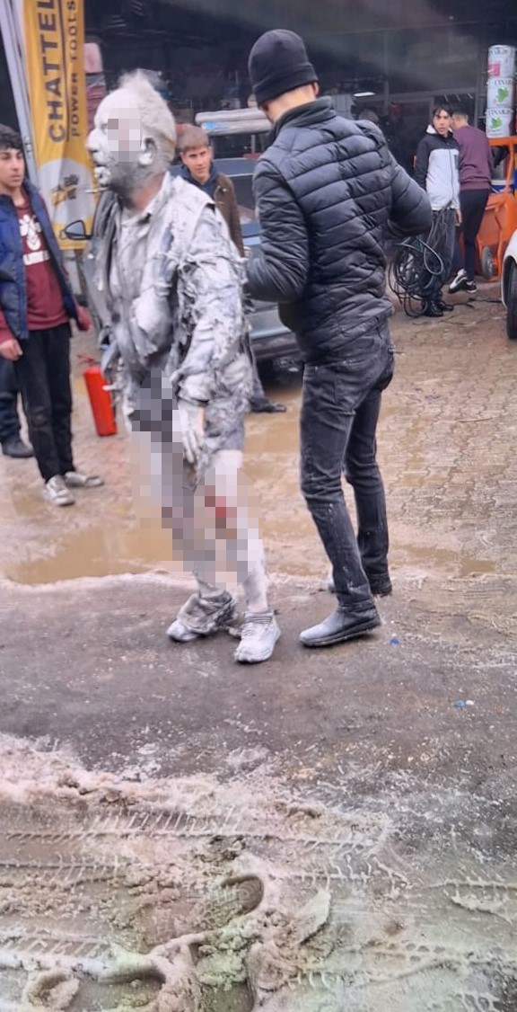 Oto sanayide patlama: 4 yaralı
