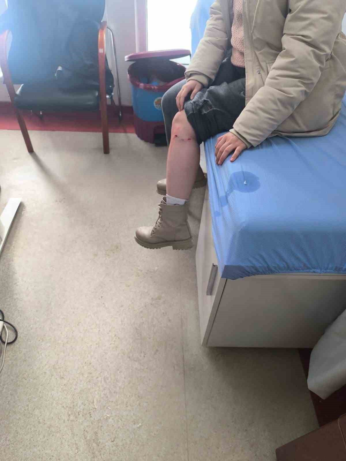 Kayseri’de sokak köpeğinin saldırısına uğrayan çocuk yaralandı