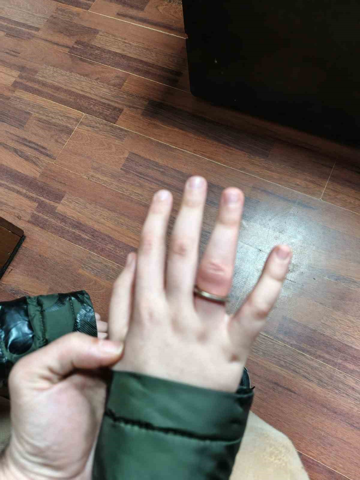 Rize&rsquo;de itfaiyeden "50 kuruşluk" operasyon
