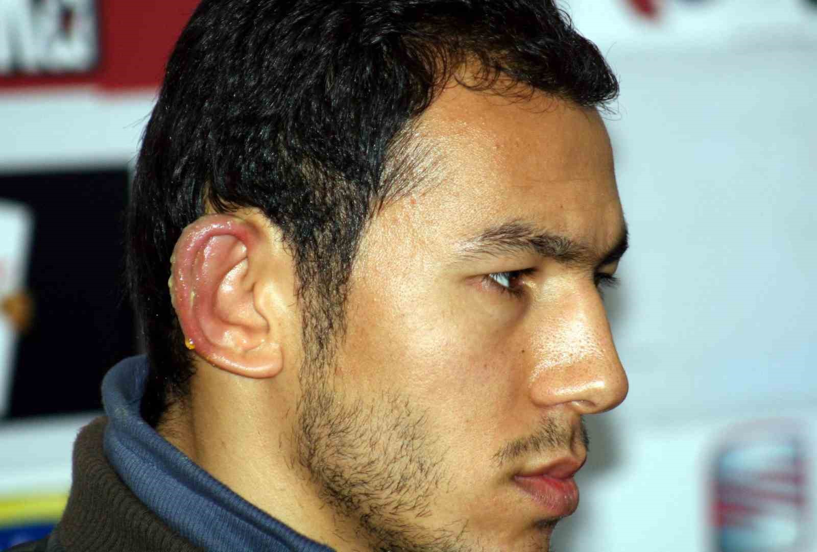 Uzmanı dondurucu soğuklara karşı uyardı: "Geç kalınırsa uzuv kaybı olabilir"