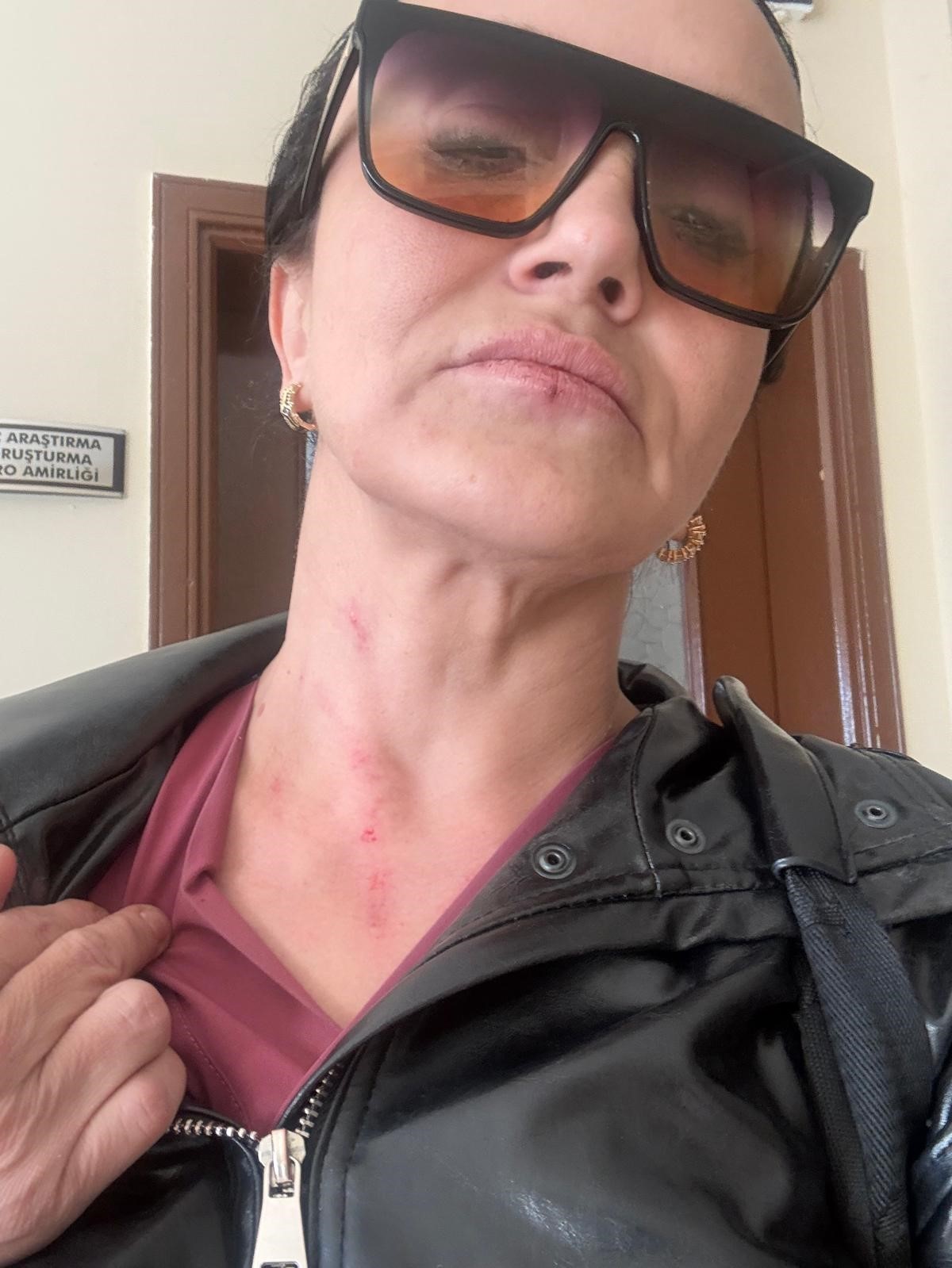 Boşanmaya &ccedil;alıştığı eşi, yapmadığını bırakmadı
