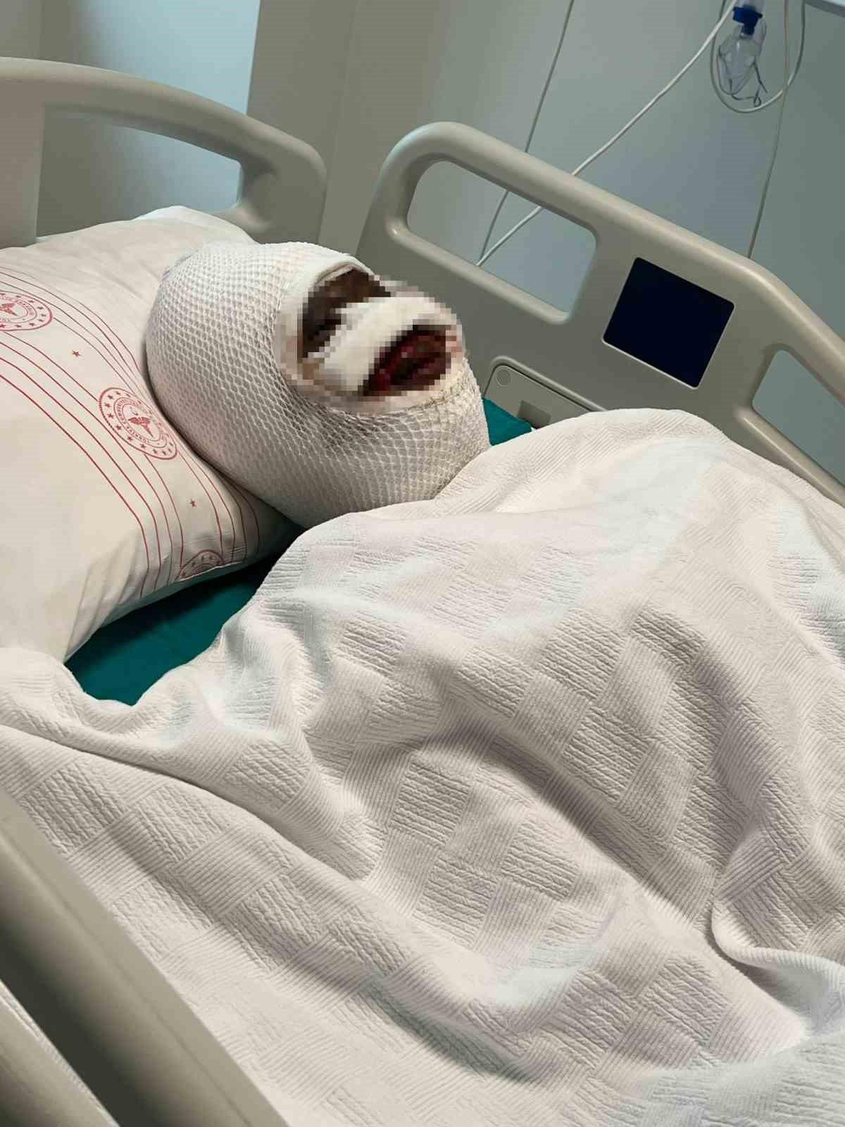 Eski eşi tarafından vahşete uğrayan kadın o anları anlattı, acılı baba sert tepki g&ouml;sterdi
