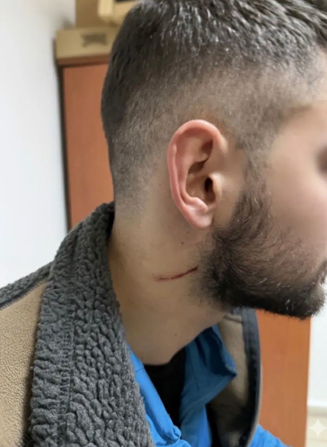 Kartepe&rsquo;deki kavganın en b&uuml;y&uuml;k mağduru &ccedil;ocuklar oldu: "Babama 5 kişi saldırdılar, kafasını ATV&rsquo;ye vurdular"
