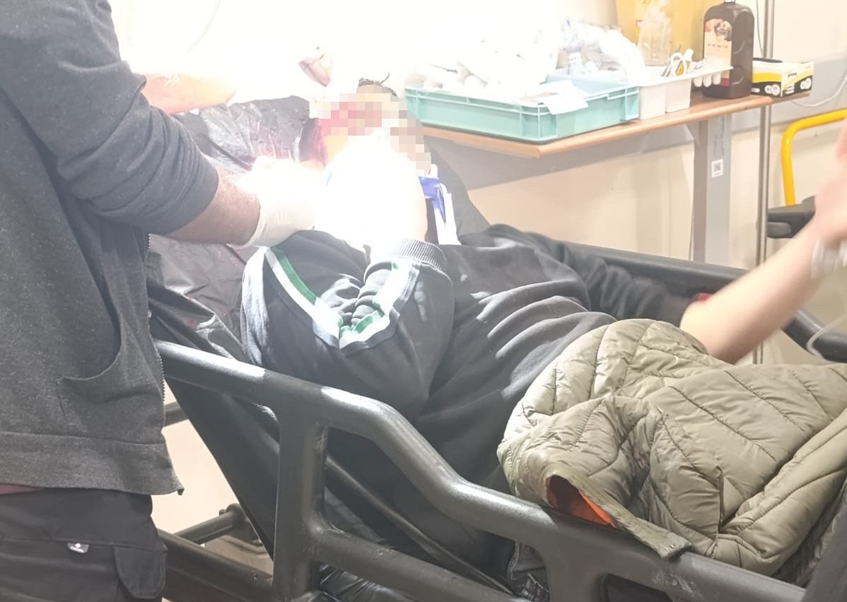 Malatya&rsquo;da otob&uuml;s ile otomobil &ccedil;arpıştı: 2 yaralı
