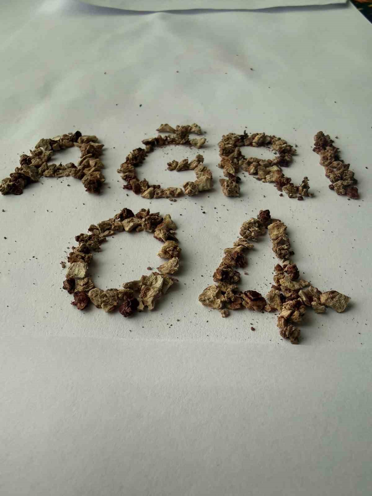 Ağrı&rsquo;da zorlu taş cerrahisi başarıyla ger&ccedil;ekleştirildi
