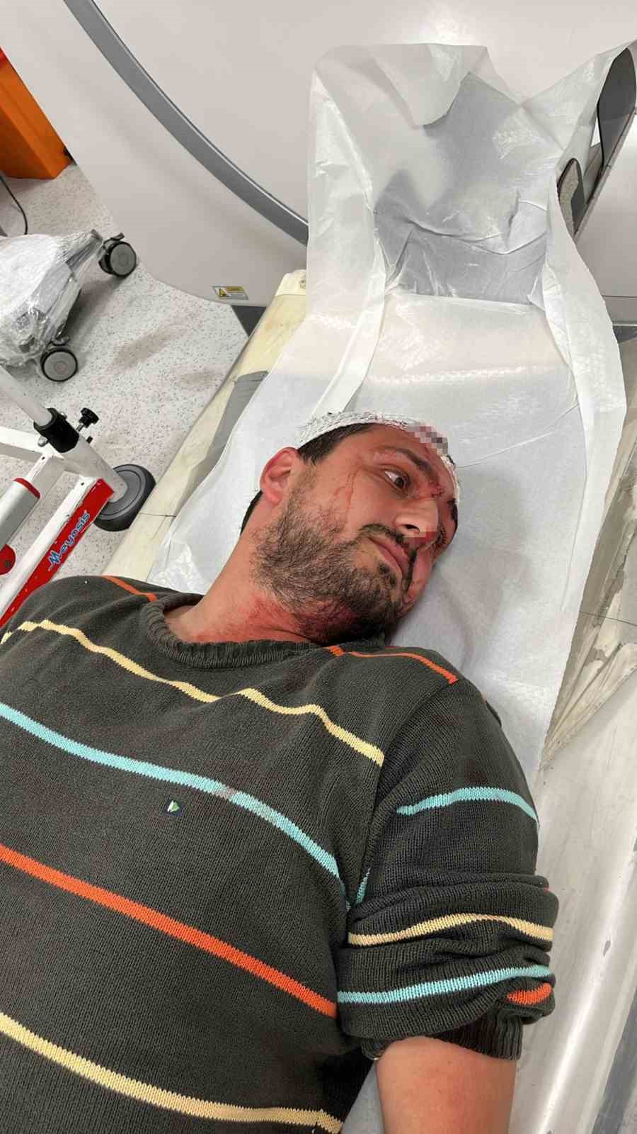 Otizmli adamı &ouml;ld&uuml;resiye darp eden sanık ilk kez konuştu
