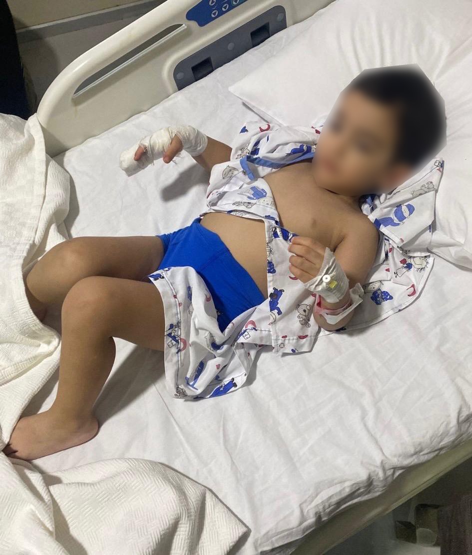 Özel okulda skandal görüntü kameraya yansıdı: Çocuğun parmakları bu hale geldi