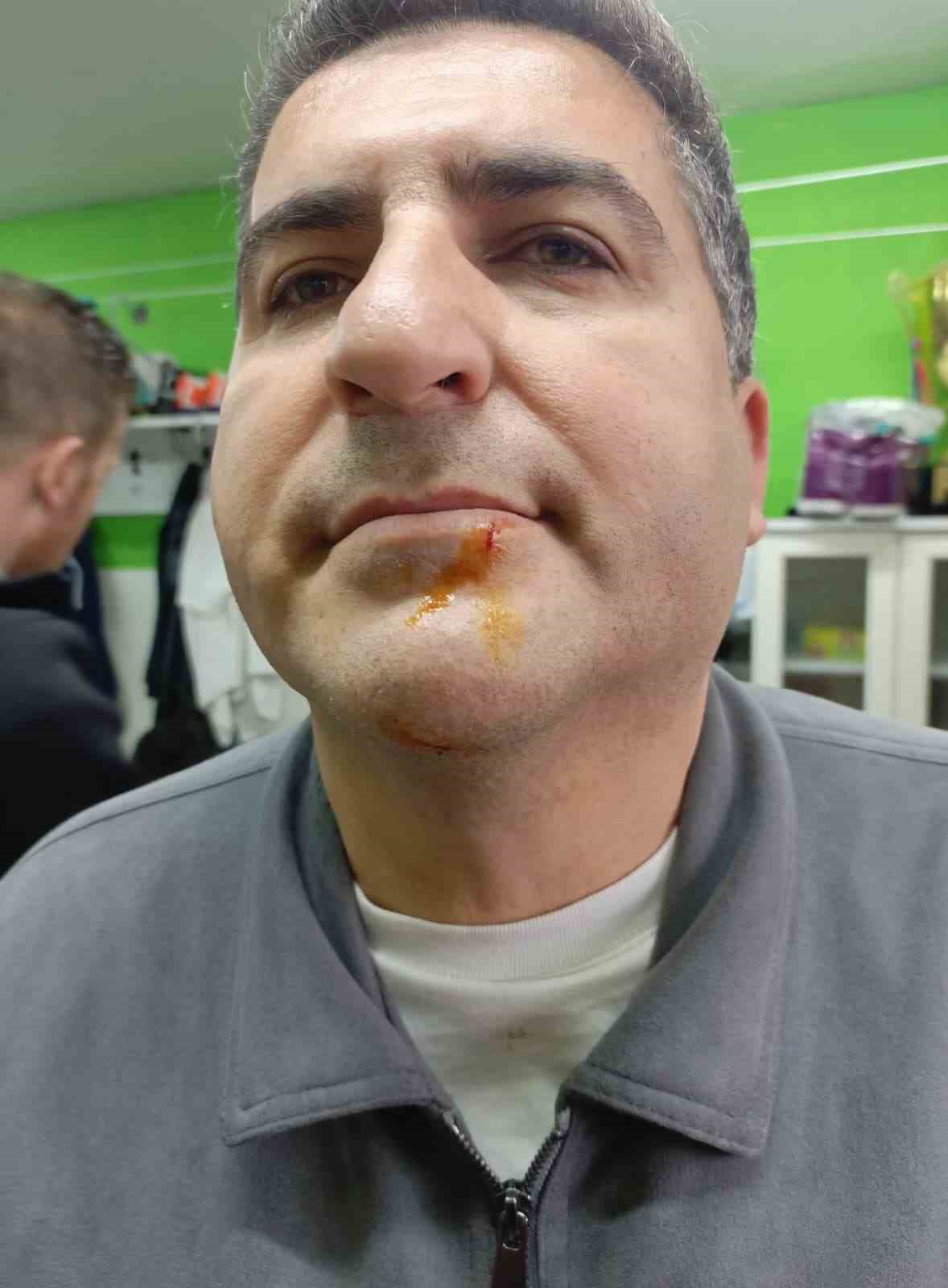 Zonguldak’ta 3. Lig maçı sonrası gerginlik: 2 gazeteci darbedildi, 2 polis yaralandı