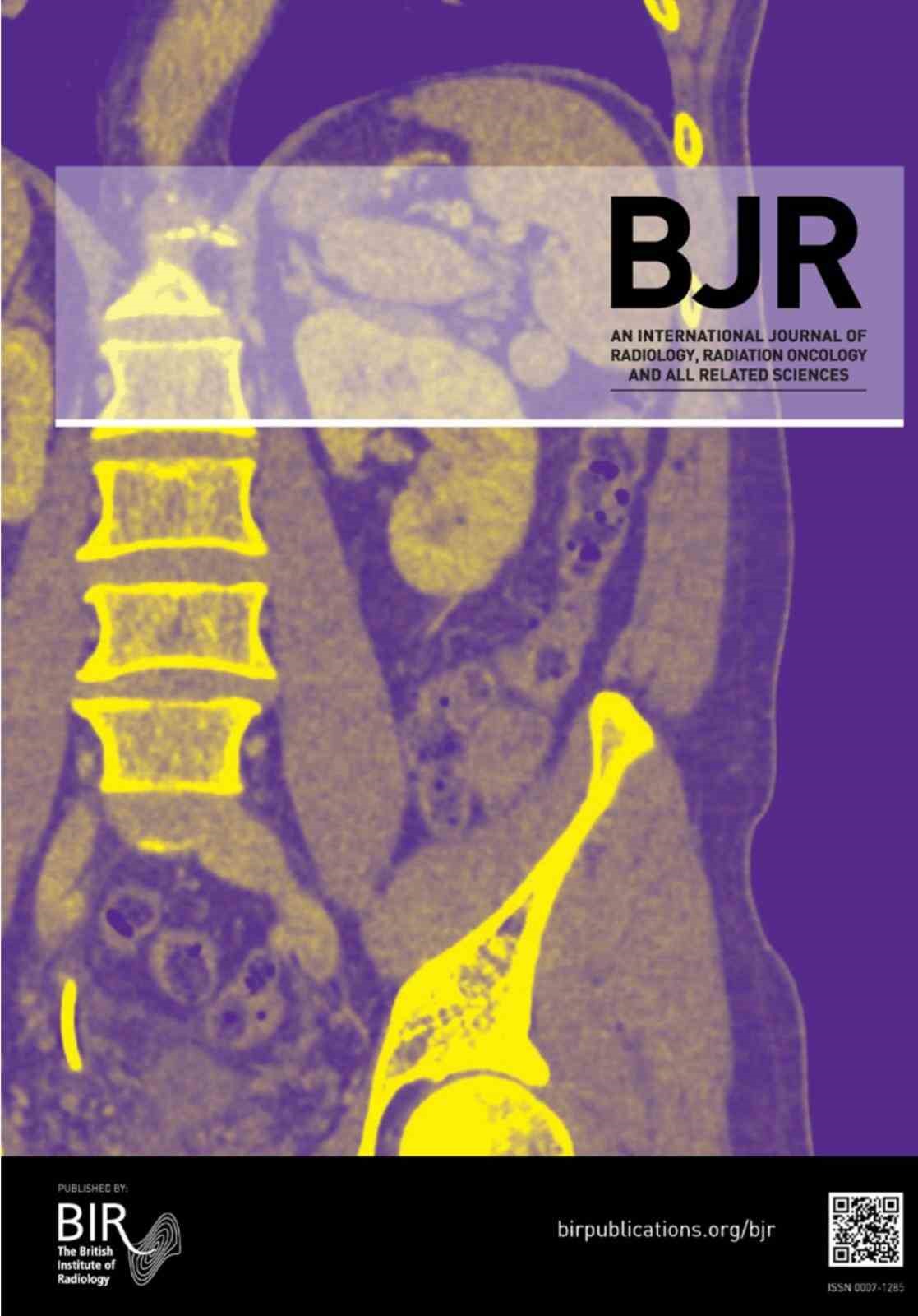 Akciğer damarındaki pıhtıların tanısında radyasyonsuz çözüm