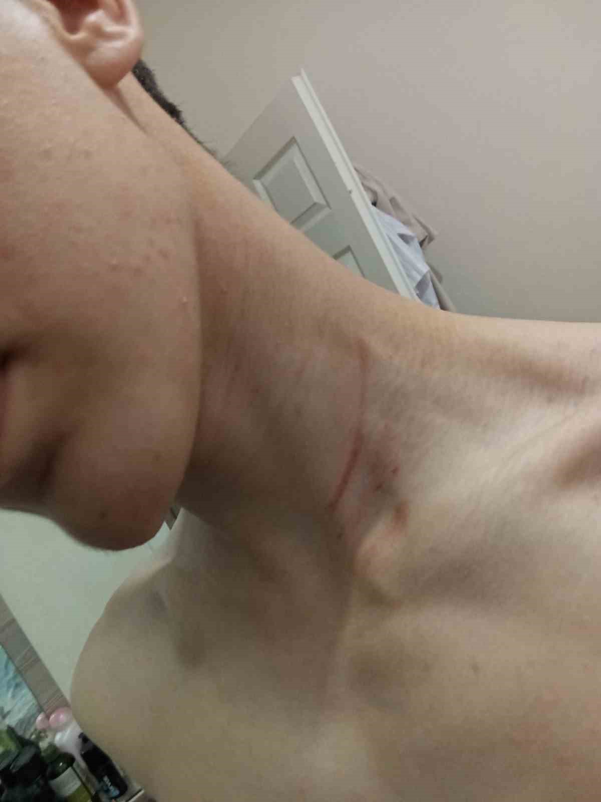 K&uuml;&ccedil;&uuml;k&ccedil;ekmece&rsquo;de 16 yaşındaki &ccedil;ocuğu "fotoğraf &ccedil;ektin" iddiasıyla darbettiler
