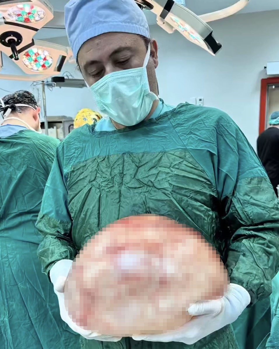 Van&rsquo;da bir kadının karnından 35 santimetrelik dev kitle &ccedil;ıkarıldı
